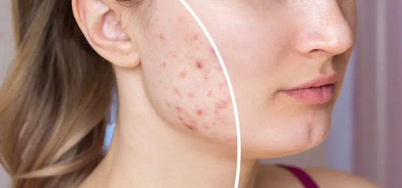 Chirurgie de la peau Casablanca