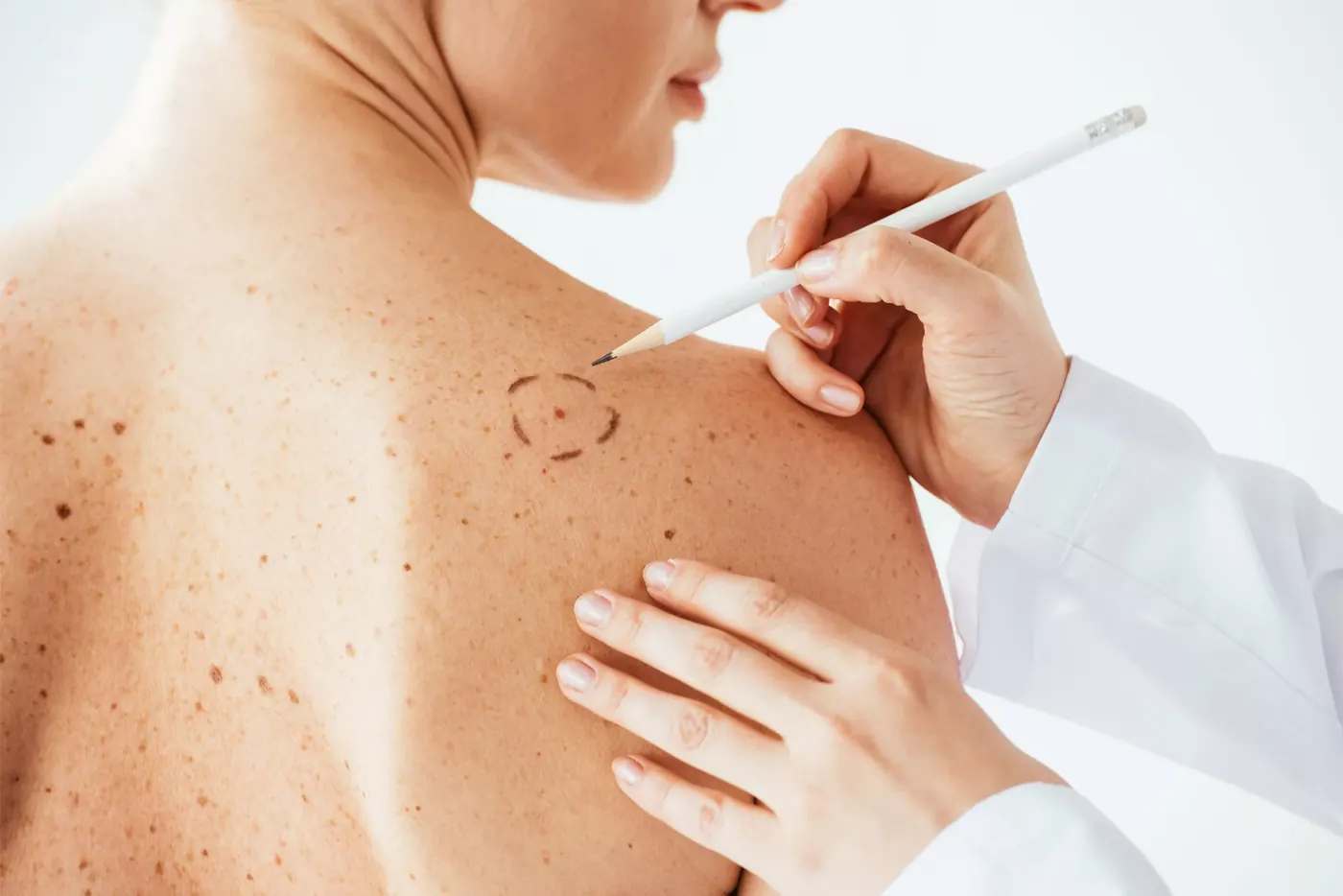 Consultation dermatologie Casablanca