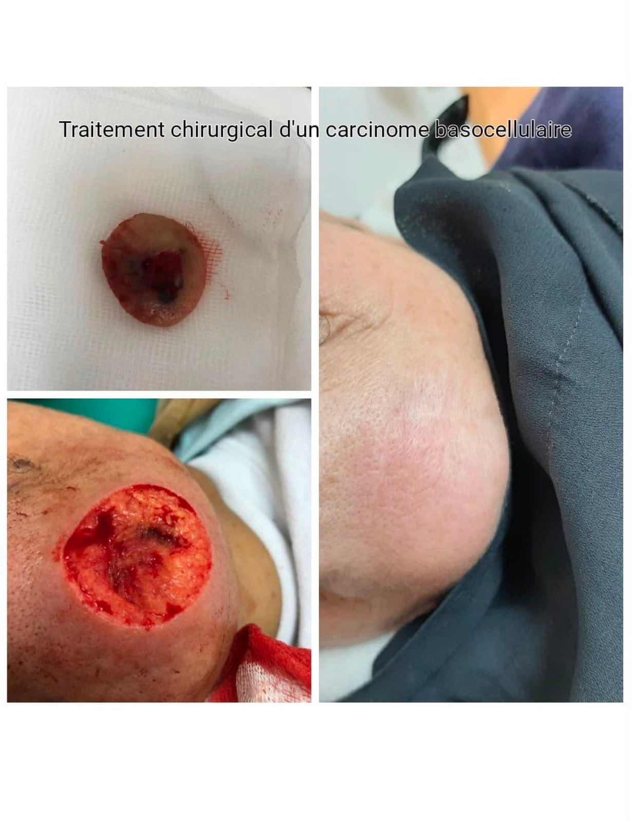 Résultat 2
